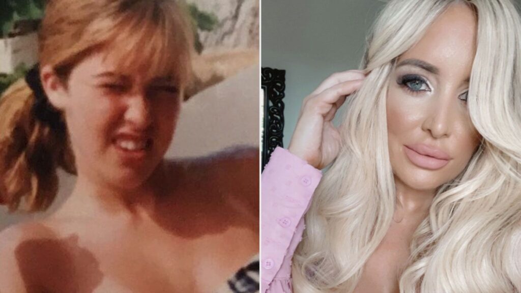 Mom Spends $30K on Cosmetic Procedures to Change Her Appearance, Only to Receive a Shocking Diagnosis