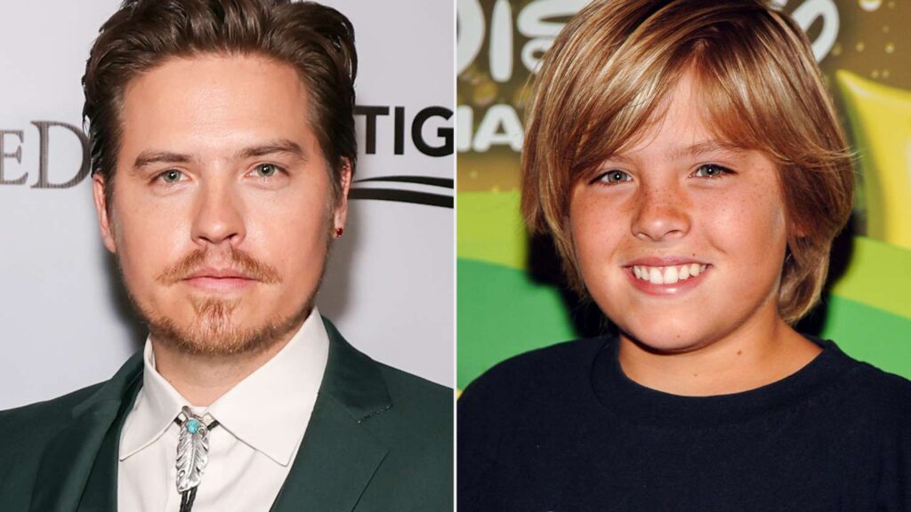 Dylan Sprouse Compares His Start in Acting to ‘Child Labor’