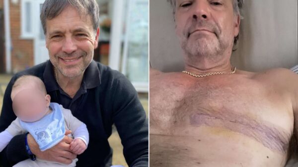 Man, 63, Said His Doctors Told Him Pea-Sized Lump on His Chest Was ‘Probably Nothing.’ It Turned Out to Be Breast Cancer