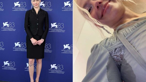 Phoebe Bridgers Praised by Fans for Showing Leg Hair and Pit Stains at Glamorous Venice Film Festival
