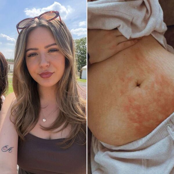 Sisters Both Get Diagnosed with Endometriosis After Doctors Dismissed Their Debilitating Pain as ‘Just Bad Periods’ for Years