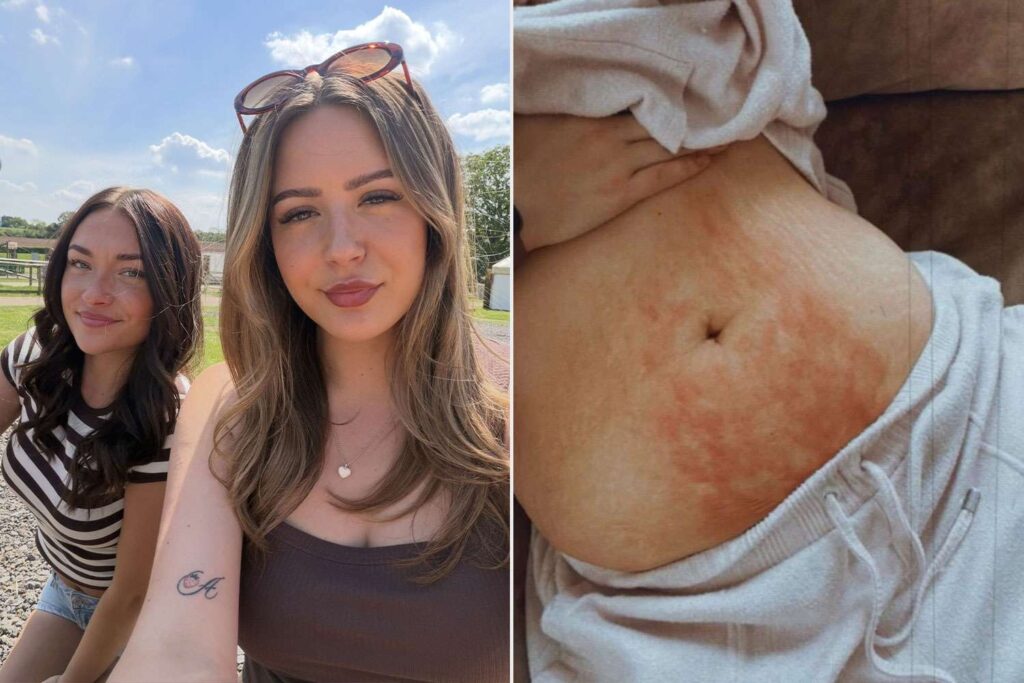 Sisters Both Get Diagnosed with Endometriosis After Doctors Dismissed Their Debilitating Pain as ‘Just Bad Periods’ for Years