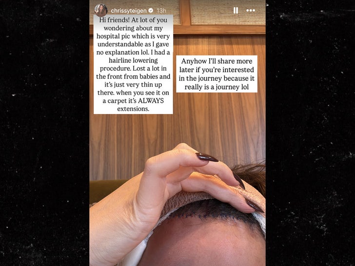 chrissey teigen hospital stitches update sub instagram