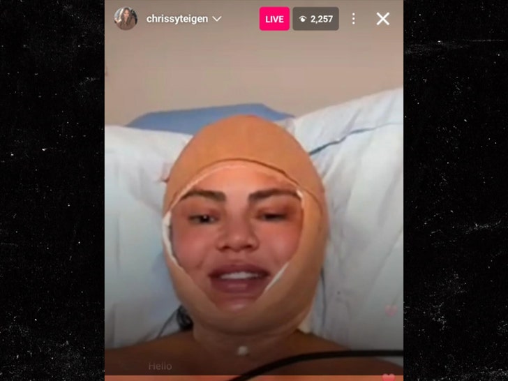 chrissy-teigen-surgery-ig-1