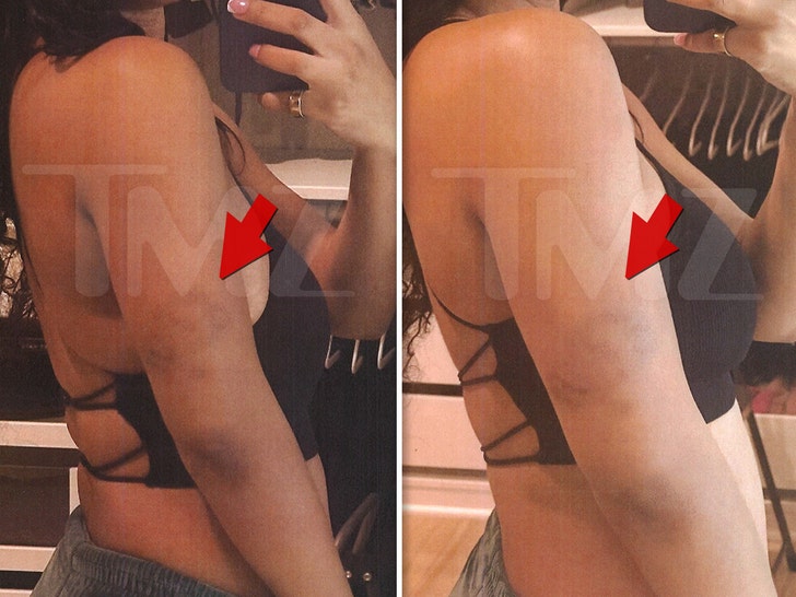Halle-Bailey-injuries-1