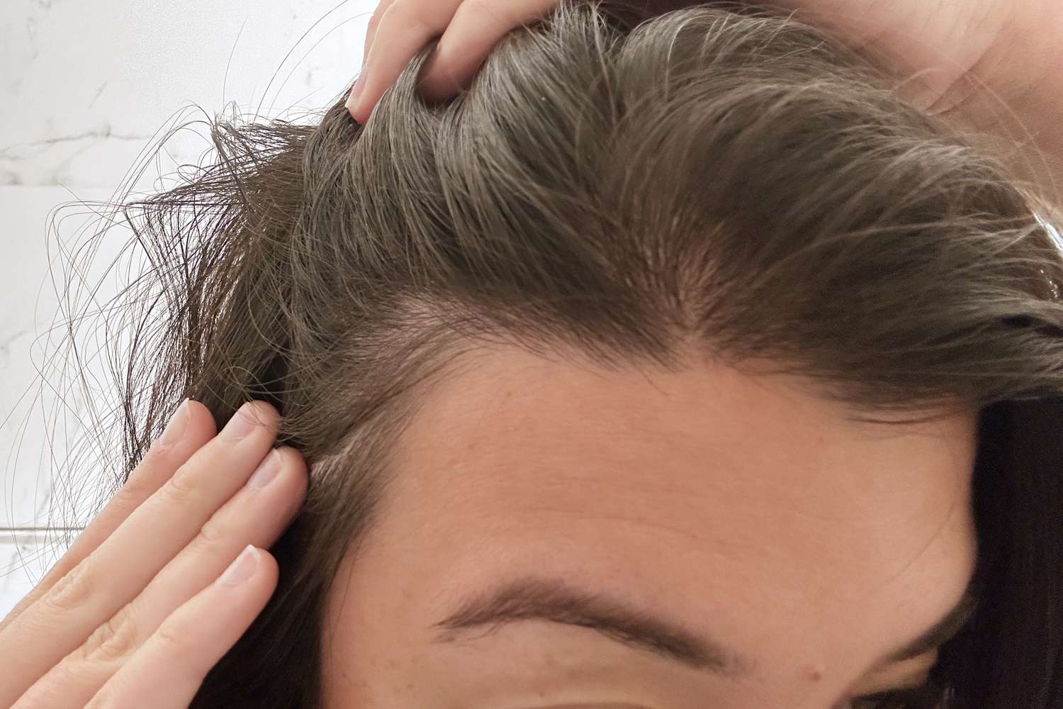 Closeup of forehead and hairline with hands separating hair into sections