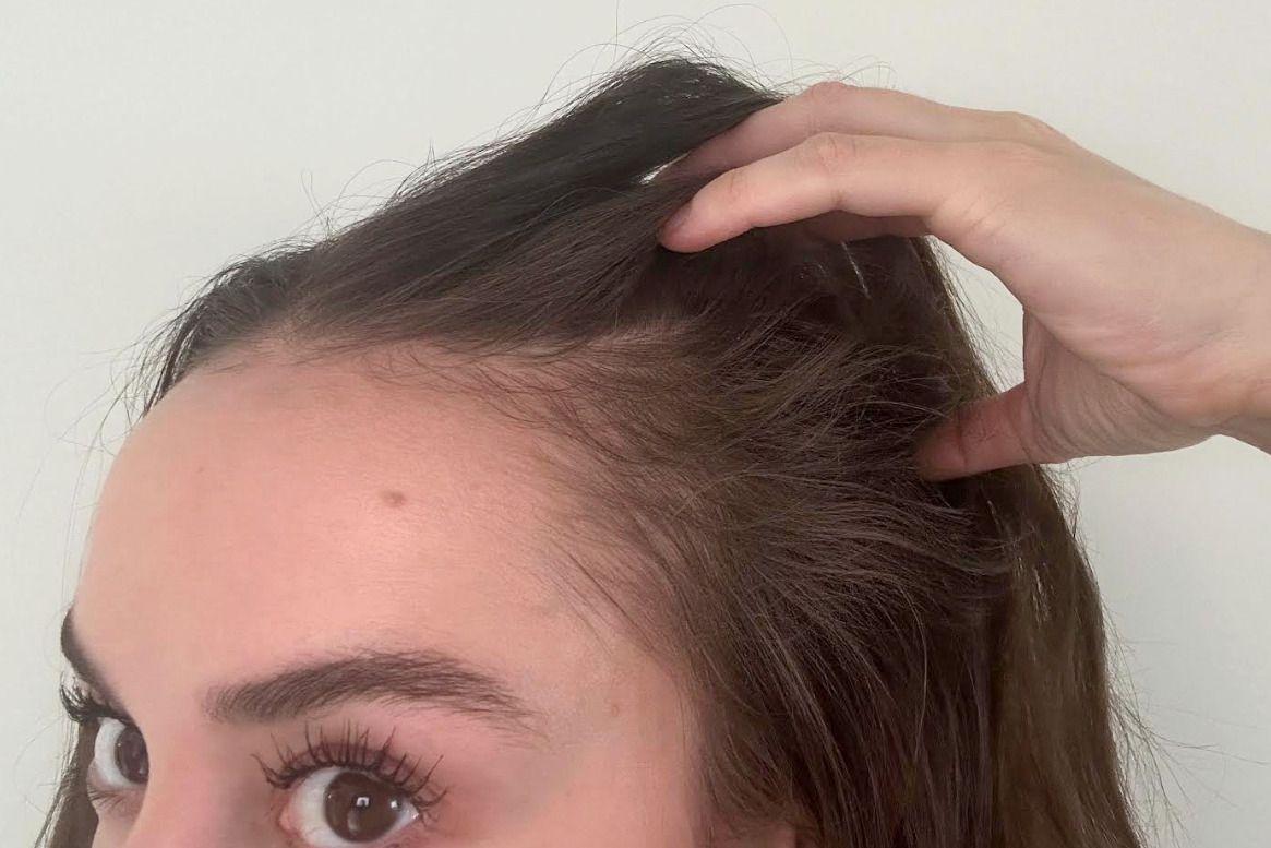 A person after using Advanced Trichology NutraM Topical Melatonin Hair Growth Serum 