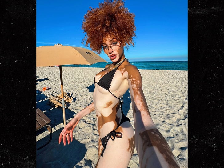 0717-Winnie-Harlow-Hot-Shot-SUB-2