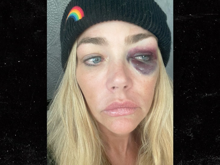 denise ricahrds and Aaron Phypers alleged injuries lawsuit 3