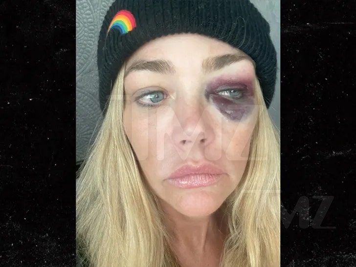 denise ricahrds and Aaron Phypers alleged injuries lawsuit 6