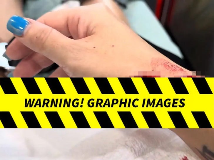 Car Crashes Into Restaurant -- The Gruesome Injuries