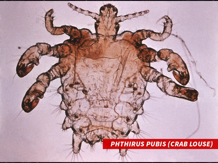 Phthirus pubis (crab louse) sub getty swipe