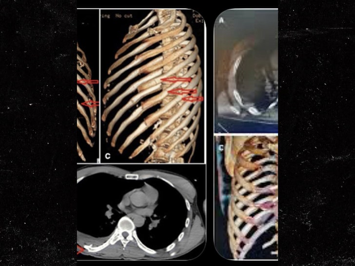 Corey-Harrison-sub-ig-1