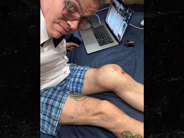 steve o knee handout 1