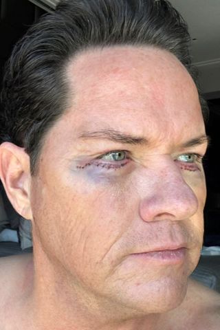 Dolores Catania Fiance Paulie Connell Reveals He Got a Blepharoplasty to Pinch Excess Skin After Dramatic Weight Loss Paulie Connell.Credit: paul_g_connell/Instagram