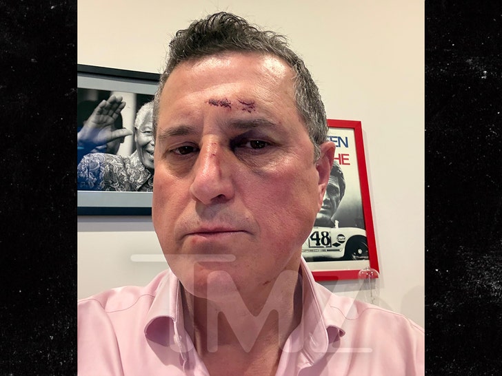 ronnie taylor injuries tmz handout 2