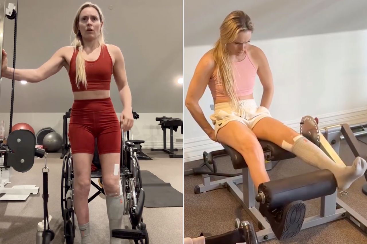 Lindsey Vonn Already Working Her Injured Leg in Rehab One Week After Revealing It Was Nearly Amputated Lindsey Vonn has been sharing her recoveryCredit: Lindsey Vonn/Instagram