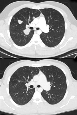 Spencer Laird Scans Spencer Laird's medical scansCredit: Duke Health