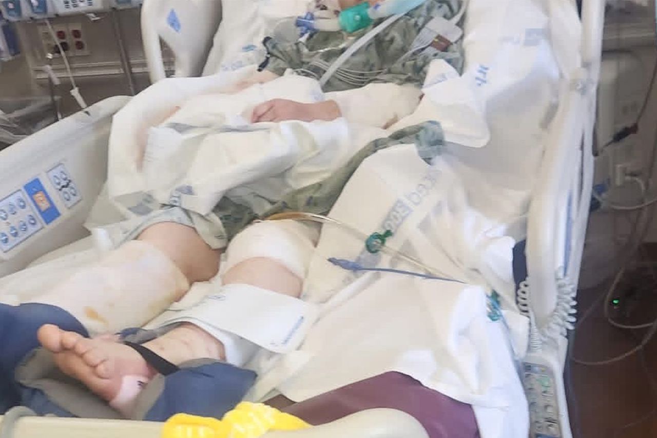 Alicia Mexley Alicia Maxey in the hospital after several surgeriesCredit: GoFundMe