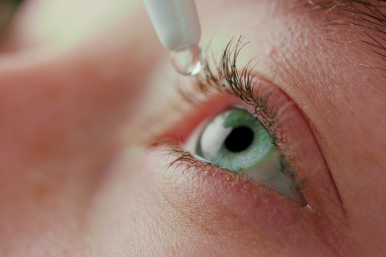 Person using eye drops.Credit: Getty Images