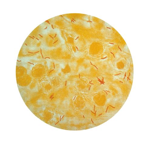 Microscopic view of Mycobacterium tuberculosis bacteria Microscopic view of mycobacterium tuberculosis bacteriaCredit: Smith Collection/Gado/Getty