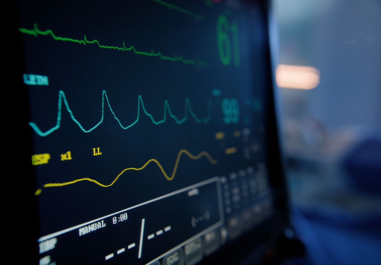 Vital signs monitor, digital and hospital with EKG machine, electronic and medical equipment to help. Emergency, stats and co Vital signs monitor (stock image)Credit: getty