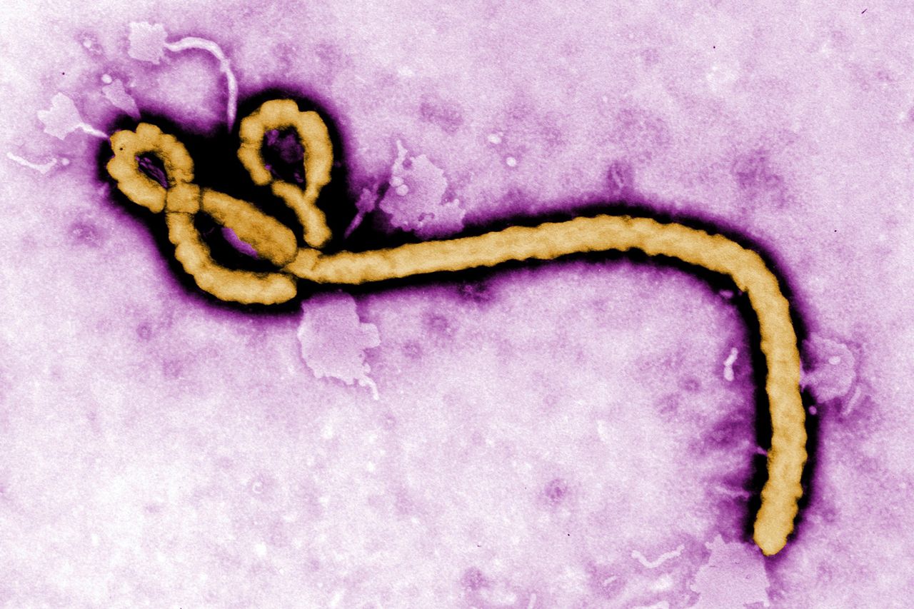 Ebola virus virionCredit: Frederick Murphy/CDC via AP