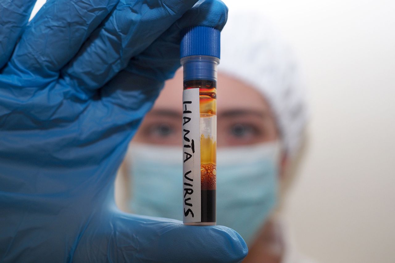 Nurse holds laboratory test tube being analyzed for hantavirusCredit: Vincenzo Izzo/LightRocket via Getty