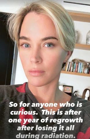 Teddi Mellencamp posted a photo of 'one year of regrowth' after losing her hair during cancer treatmentCredit: Teddi Mellencamp/Instagram