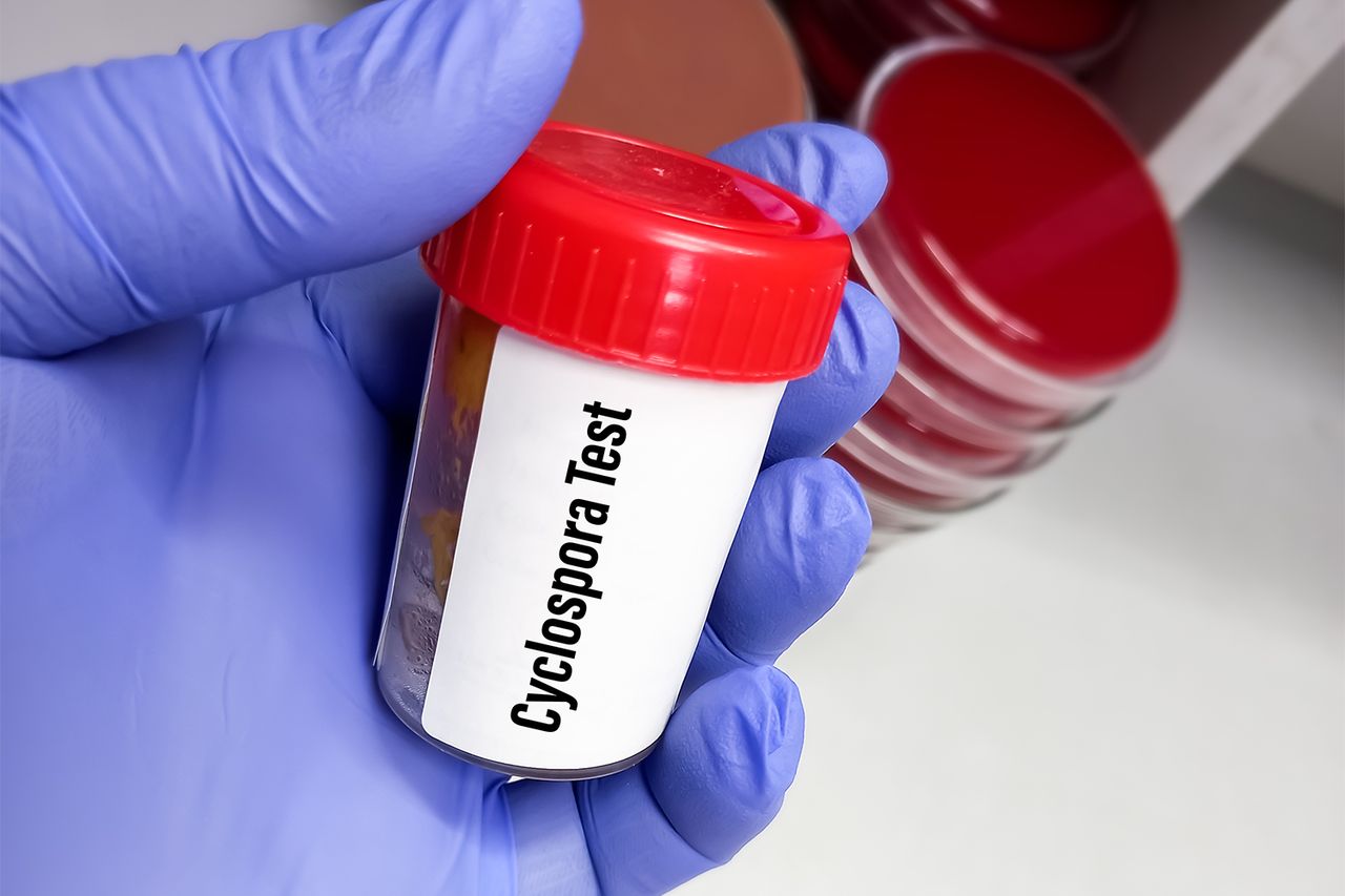 Technician tests for cyclosporaCredit: Getty