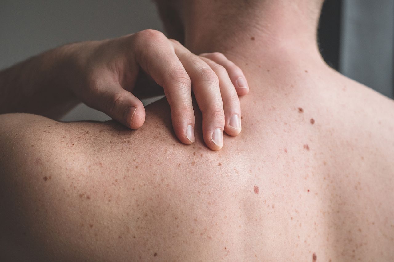 Stock photo of molesCredit: Getty