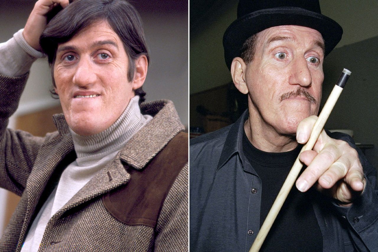 Paul Benedict From left: Paul Benedict as Harry Bentley on ‘The Jeffersons’; Paul Benedict takes his cue at a rehearsal for ‘The Music Man’ musical at the Lawrence A. Wien Center in N.Y.C. on March 15, 2000Credit: CBS via Getty; Richard Corkery/NY Daily News Archive via Getty