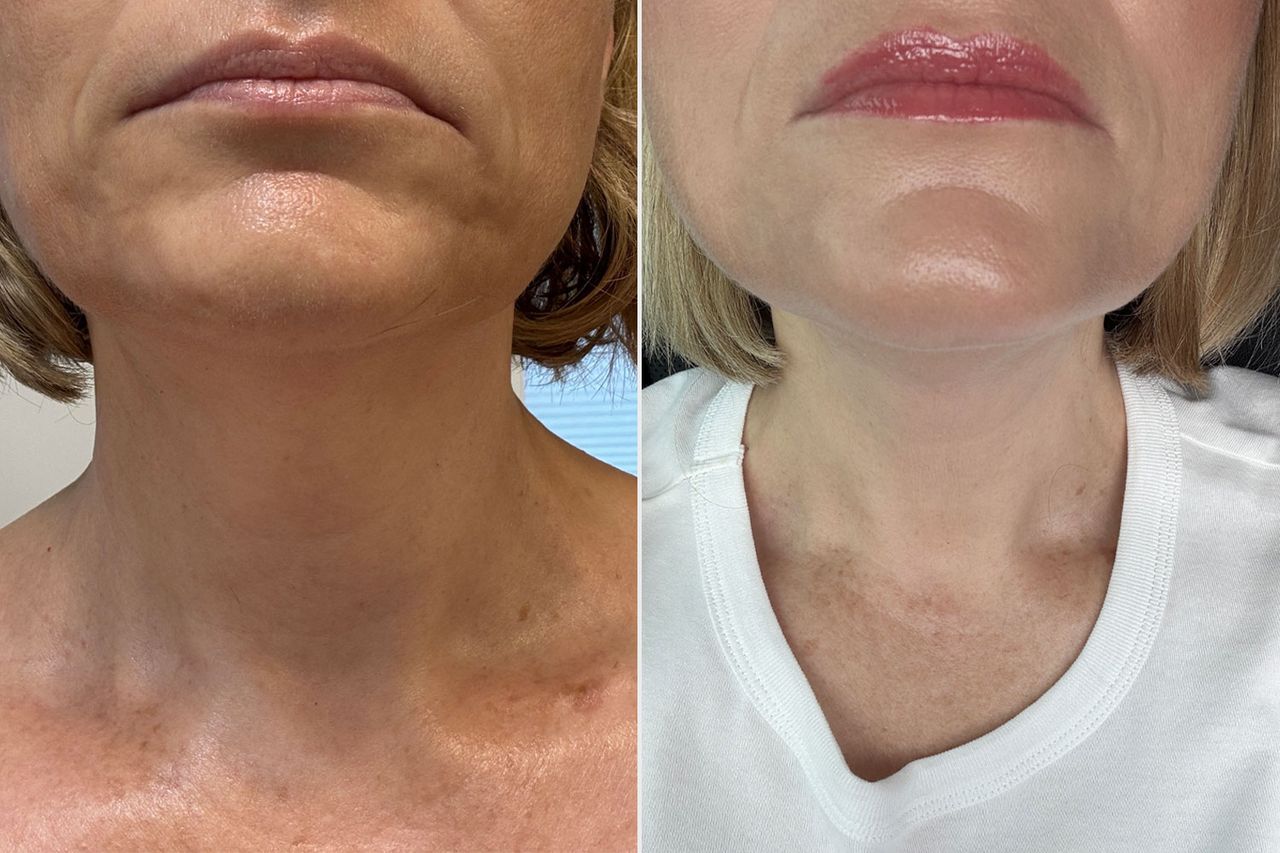 Before (left) and after (right).Credit: People