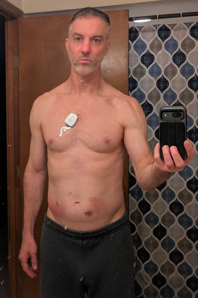 Michael Lomonaco goes from struggling to walk to lifting 225 lbs after rare-disease treatment Michael Lomonaco.Credit: Courtesy of Michael Lomonaco