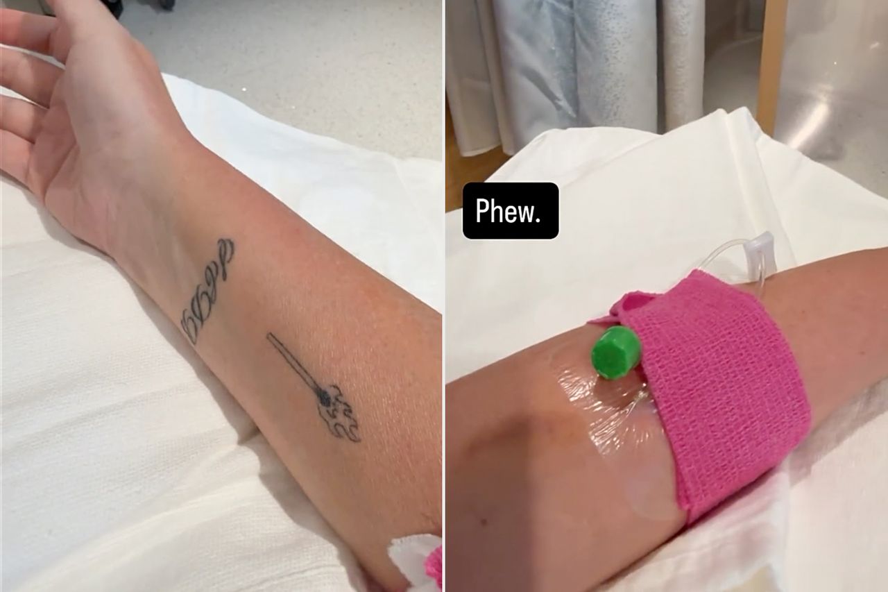 Teddi Mellencamp's arm Teddi Mellencamp shared that doctors struggled to find a veinCredit: Teddi Mellencamp/Instagram (2)