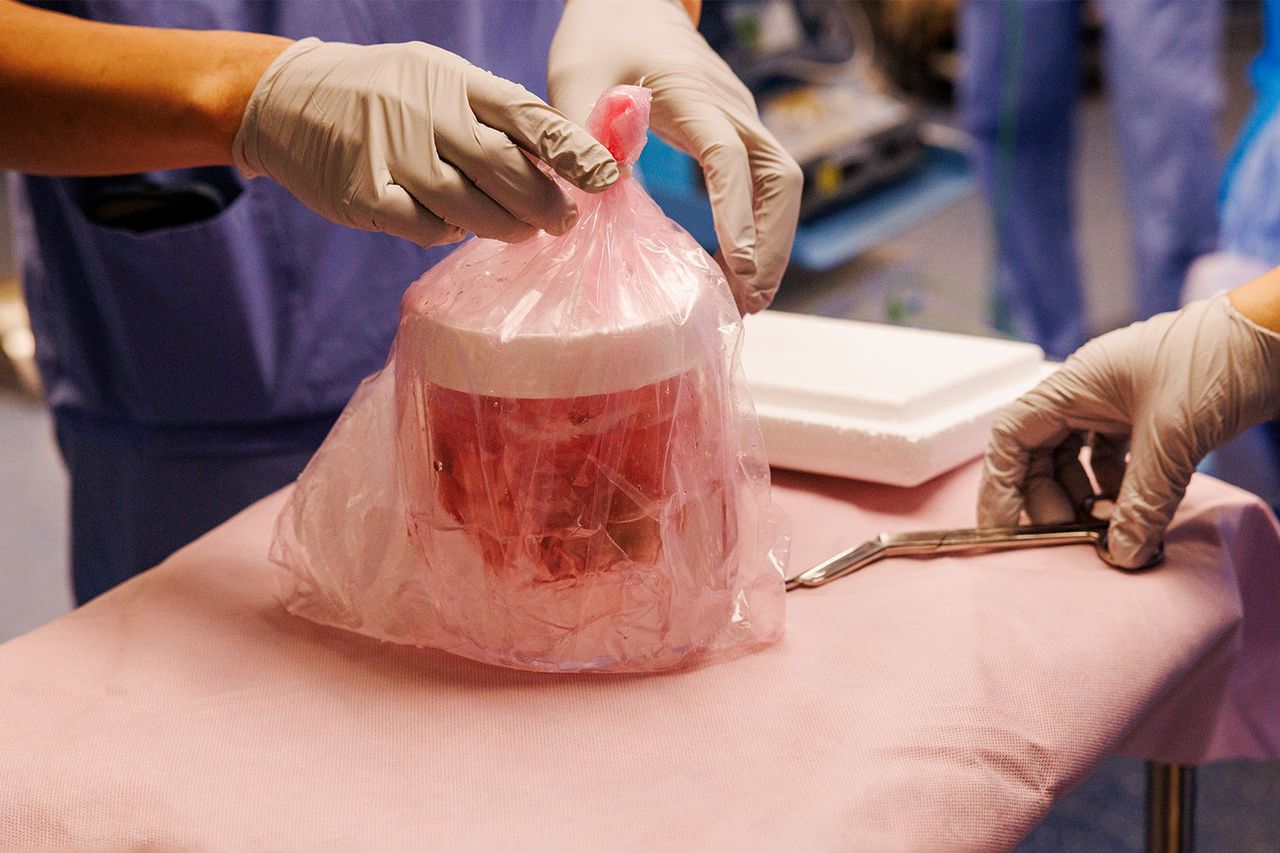 Surgeons successfully transplanted a genetically-edited pig kidney into Tim AndrewsCredit: Kate Flock/Massachusetts General Hospital