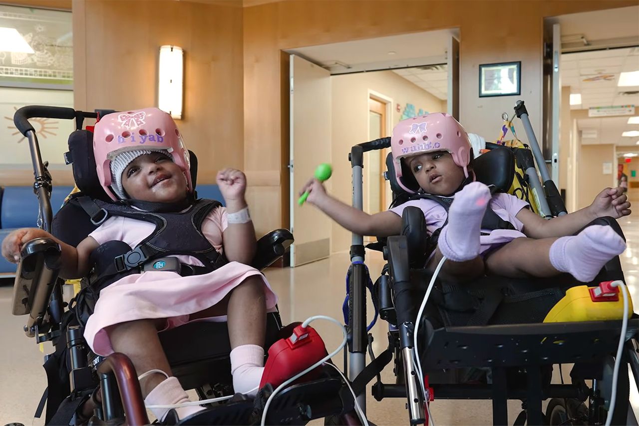 Twin sisters Hiyab and Wuhbto.Credit: SSM Health Cardinal Glennon Children's Hospital