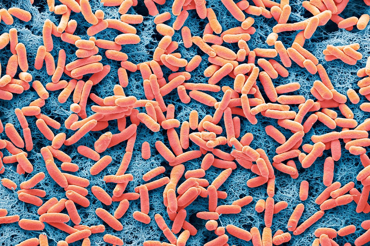 Stock image of E. coli under a microscopeCredit: Getty